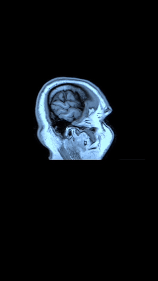 IRM Corps entier — Centre Européen de Radiologie Nador